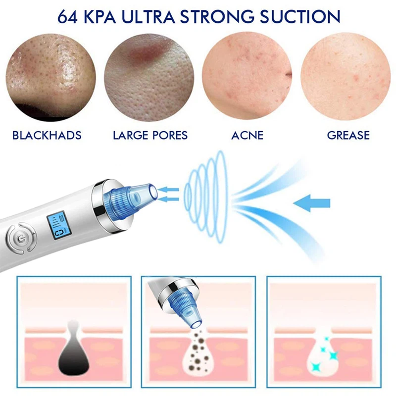 Blackhead Remover 5 Blackhead Remover 5