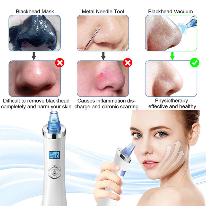 Blackhead Remover 6 Blackhead Remover 6